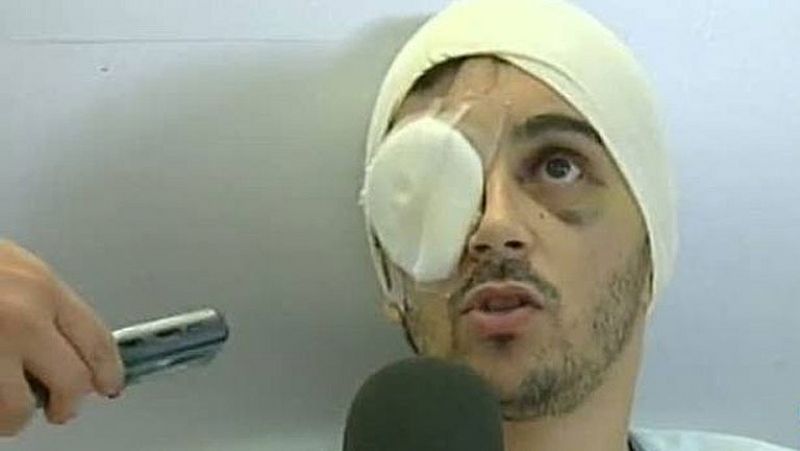 La justicia ordena reabrir el caso de un joven que perdió un ojo por una pelota de los Mossos