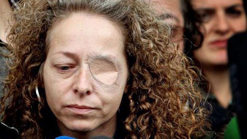 El juez ve "imprudente" la actuación de los mossos que hizo perder un ojo a una mujer