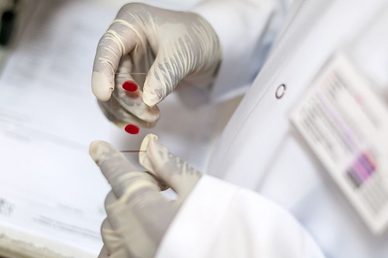 Un nuevo test creado en España abarata y precisa la detección de la resistencia a fármacos del VIH
