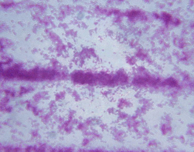 Las focas introdujeron la tuberculosis en América hace mil años, según un estudio