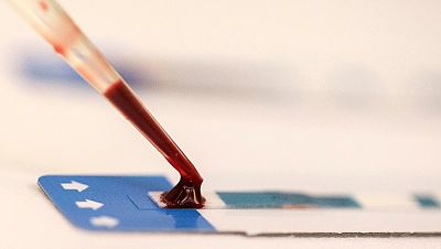 Voluntarios en Reino Unido participan en una investigación para buscar una vacuna contra el ébola | Ver Voluntarios en Reino Unido participan en una investigación para buscar una vacuna contra el ébola | Ver