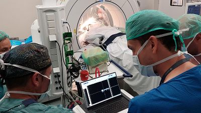 Operació de neurocirurgia per implantar ECP a un pacient per millorar la síndrome de Tourette Operació de neurocirurgia per implantar ECP a un pacient per millorar la síndrome de Tourette