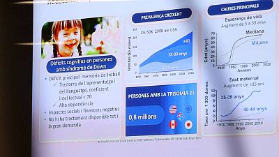 Arrenca l'assaig clínic d'un medicament per millorar la funció cognitiva de persones amb la síndrome de Down