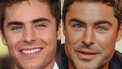 Cada cop més homes recorren a la cirurgia estètica. Cada cop més homes recorren a la cirurgia estètica.