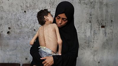 Los menores gazatíes, los más vulnerables ante la hambruna | Ver