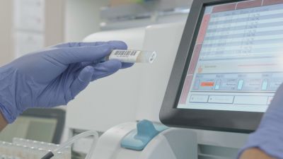 Detectar el cáncer de colon a tiempo salva 9 de cada 10 vidas