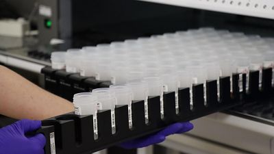 Diferents mostres de dones per analitzar si hi ha rastre del VPH i prevenir el càncer de coll d'úter | ACN