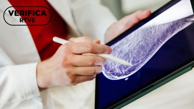 Día Mundial contra el Cáncer de Mama: así puede la IA mejorar su detección Día Mundial contra el Cáncer de Mama: así puede la IA mejorar su detección