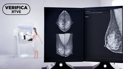 ¿Qué es y cómo funciona el cribado de cáncer de mama en España? ¿Qué es y cómo funciona el cribado de cáncer de mama en España?