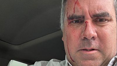 Un candidato presidencial de Perú sobrevive a un atentado tras ser tiroteado en su vehículo