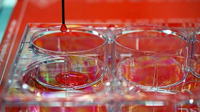 Científicos españoles diseñan una bioimpresora de piel humana