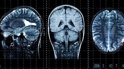 Les cinc edats del cervell - L'Altaveu - L'altaveu | Veure