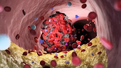 ¿En qué se diferencia el colesterol "bueno" del "malo"?: Aprende a controlarlo