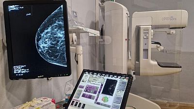 Las comunidades del PP se plantan ante Sanidad y rechazan dar los datos de sus cribados de cáncer