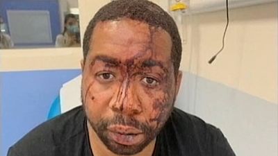 Investigan a cuatro policías en Francia tras difundirse la agresión a un hombre negro sin mascarilla