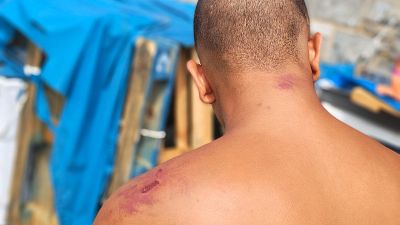 Defensa investigará los posibles malos tratos a migrantes en Ceuta y lleva la denuncia de Amnistía a la Justicia