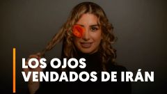 Disparos a los ojos para frenar la protesta: 