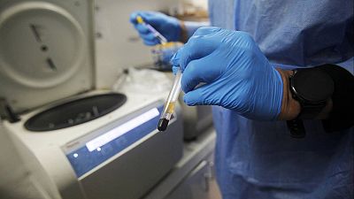 EEUU aprueba una vacuna semestral para prevenir el VIH