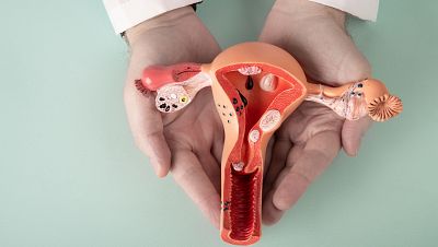 La endometriosis afecta al 10% de las mujeres en edad fértil