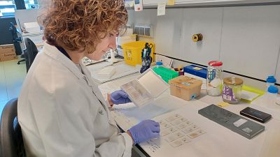Investigadores identifican que tener dos copias de un gen determinado podría favorecer la aparición del alzhéimer