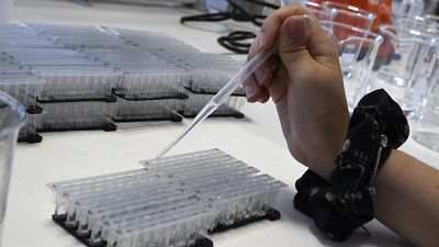 Investigadores suecos hallan pruebas de cómo el virus de la mononucleosis puede causar esclerosis múltiple