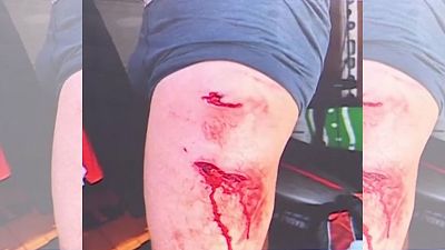 Nuevo ataque de tiburón en España: ¿Cuántos ha habido? ¿Cómo hay que actuar?