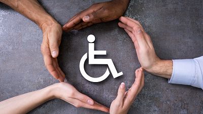 Persona discapacitada mano sin dedos desde la infancia sin uña del