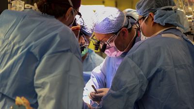 En Estados Unidos se realiza el primer trasplante a un humano vivo de un riñón de cerdo modificado genéticamente