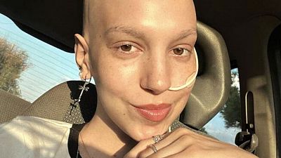 Así es el Sarcoma de Ewing, el cáncer que padeció Elena Huelva y Álex Lequio
