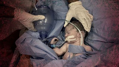 Médicos atienden a un recién nacido en Jan Yunis, Gaza, después de que su madre, embarazada de siete meses, muriera en un ataque israelí el 28 de julio de 2025.