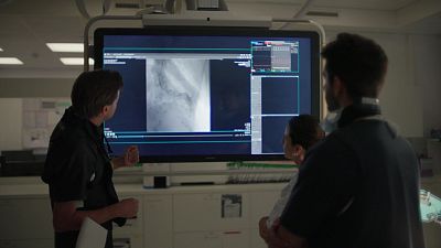 Especialistas en cardiología analizan una prueba diagnóstica del síndrome de Takotsubo o corazón roto en un hospital