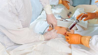 El trasplante de médula ósea crece un 42% en España desde 2012 con récord de donantes voluntarios registrados