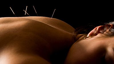 Uno de cada cinco españoles cree que la homeopatía y la acupuntura tienen base científica