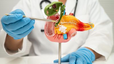 Una vacuna personalizada de ARN mensajero muestra supervivencias prolongadas en cáncer de páncreas