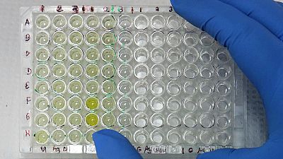 Veinticuatro nuevos casos de Zika diagnosticados en una semana en España