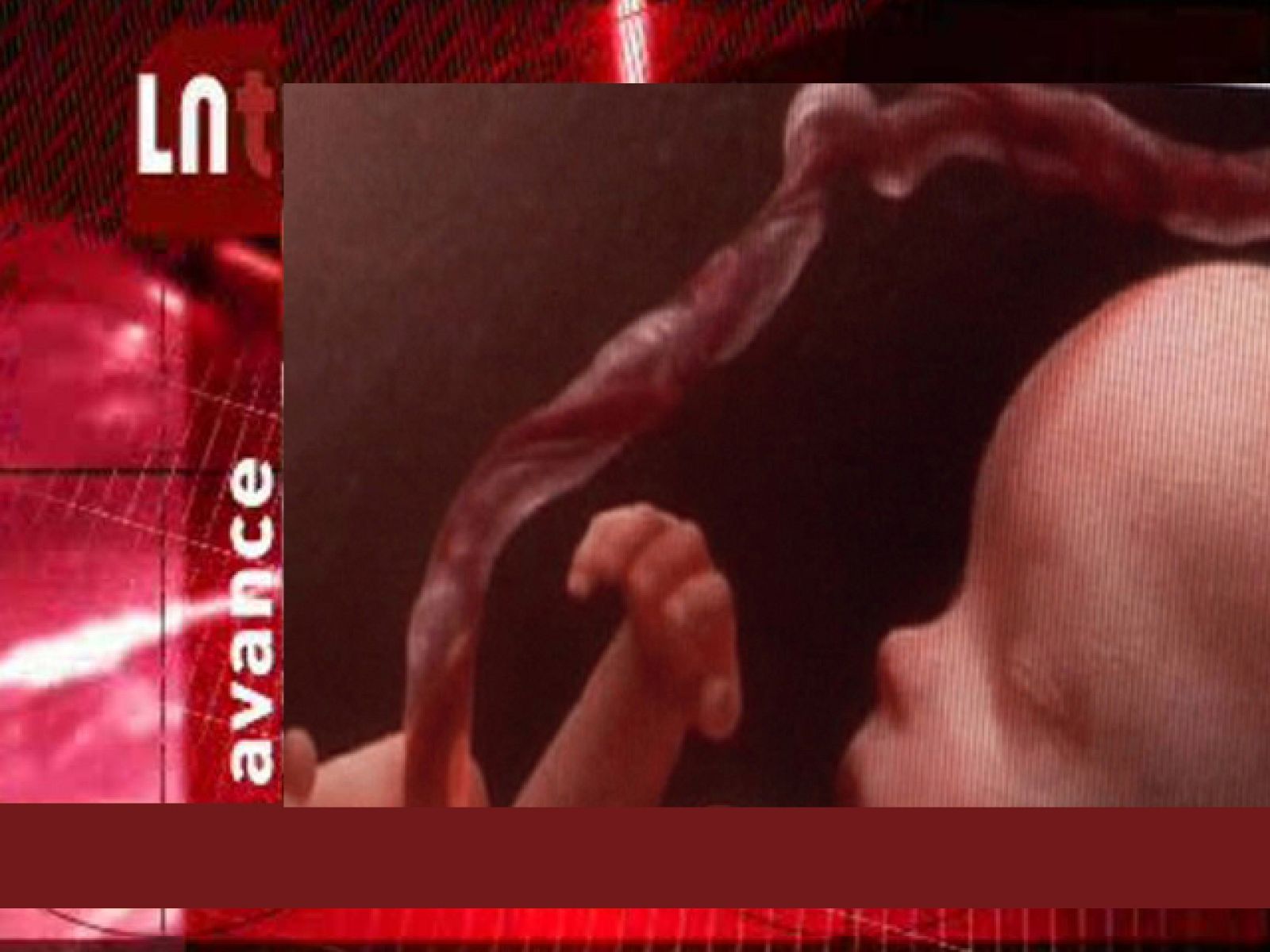 La Noche Temática. "Células madre, una nueva esperanza". Avance - La noche temática | Ver