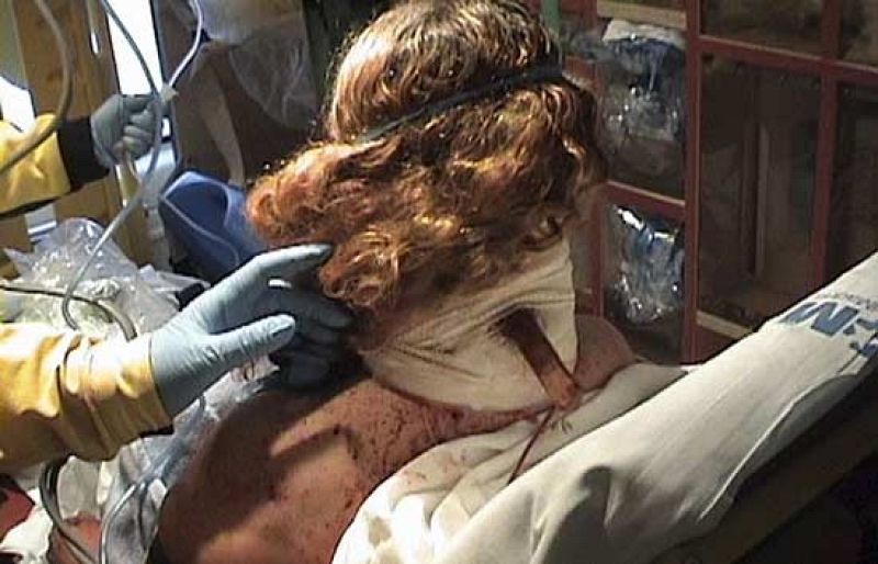 Una mujer herida grave tras ser apuñalada en el cuello en Madrid