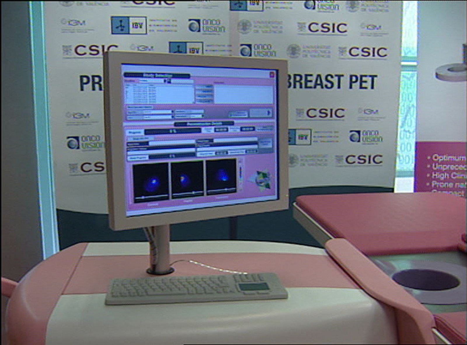 Diseñan un mamógrafo capaz de detectar el cáncer de mama un año antes que los actuales equipos de diagnóstico