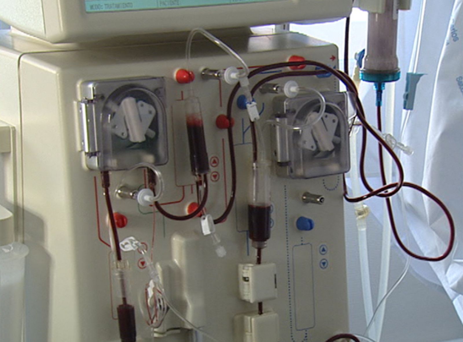 En España, 40.000 personas tienen insuficiencia renal