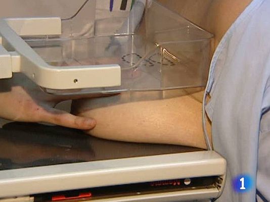 Telediario 1 - Nuevos equipos médicos que detectan tumores de mama de la cabeza de un alfiler
