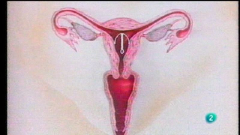 Buenas noticias TV - Los anticonceptivos - Buenas noticias TV | Ver