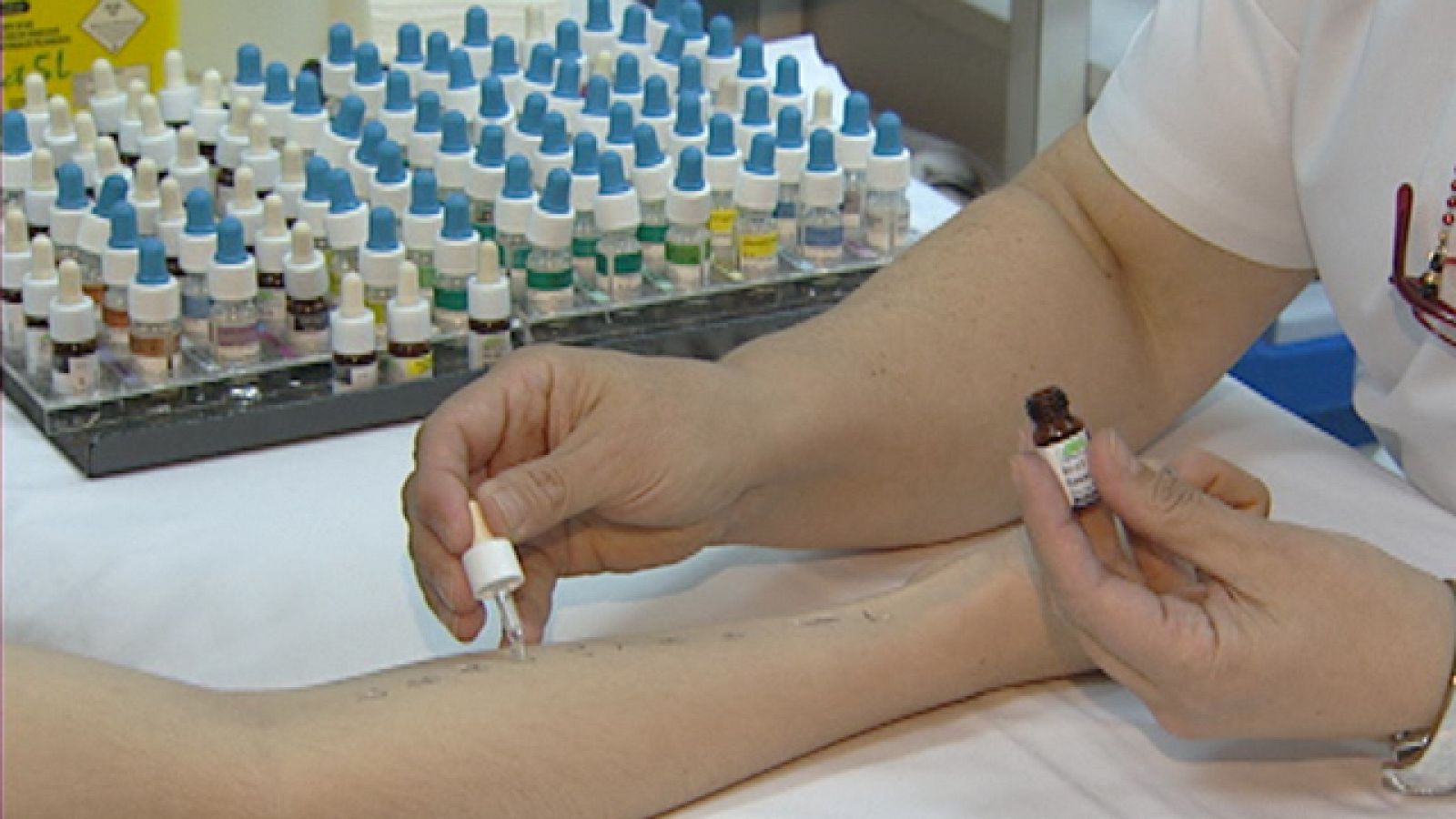 El 25% de los españoles sufre algún tipo de alergia, una cifra que no para de crecer