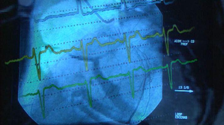 Telediario 1 - Partido de infarto