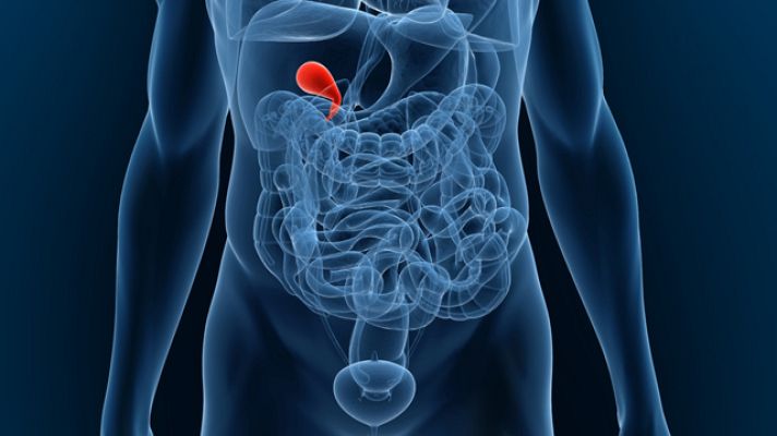 La mañana - Problemas de vesícula