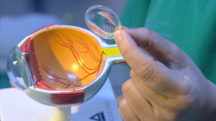 Telediario 1 - Para diagnosticar el Alzheimer