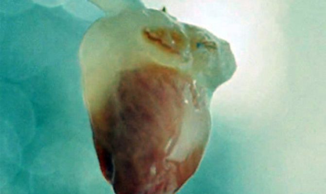 tres14 - células madre - avance