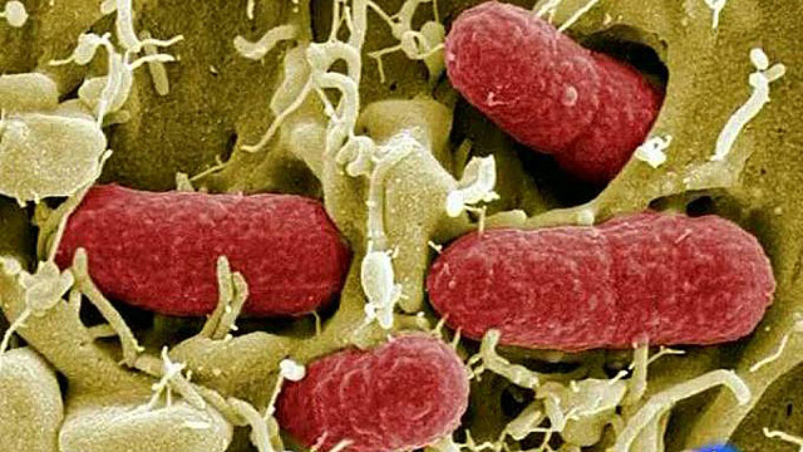 La bacteria E.Coli, responsable de las muertes en Alemania