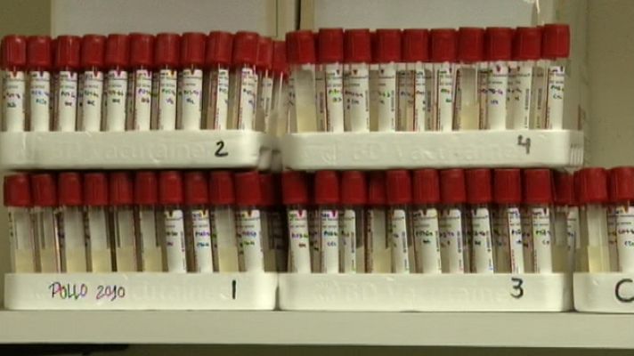 Telediario 1 - El laboratorio de referencia de la bacteria E. coli se encuentra en Lugo