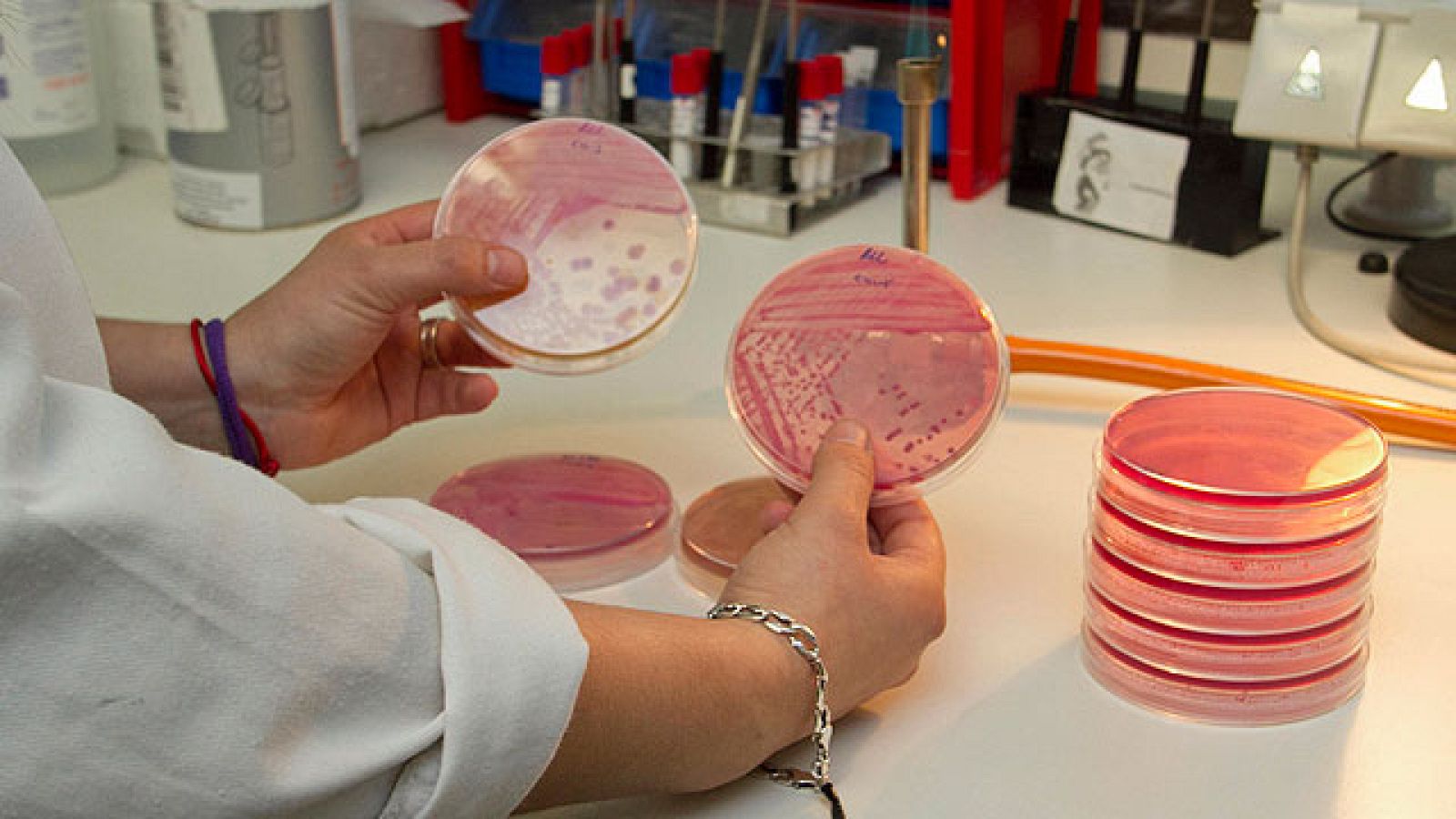 En España no ha habido ninguna infección por E. Cóli