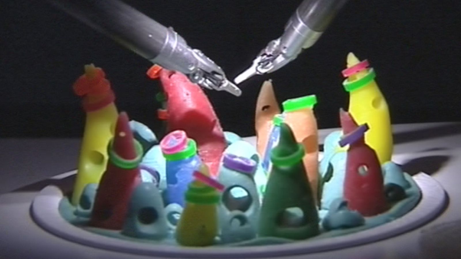 La incidencia del cáncer de próstata en la población española es mayor de la que se creía